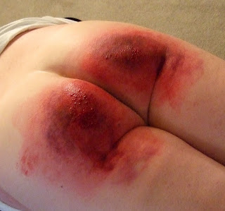 A girl is lying and displaying her Spanking Fetish in red.